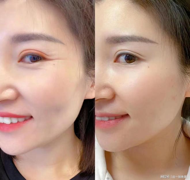 效果最好？国产眼霜推荐用对的不用贵的j9九游会登录眼霜哪个牌子抗皱去皱(图4)