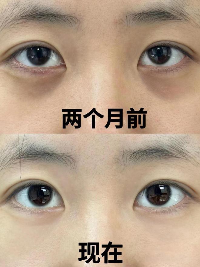 效果最好？别太会挑十款实力很强的眼霜j9九游会登录眼霜哪个牌子抗皱去皱(图7)