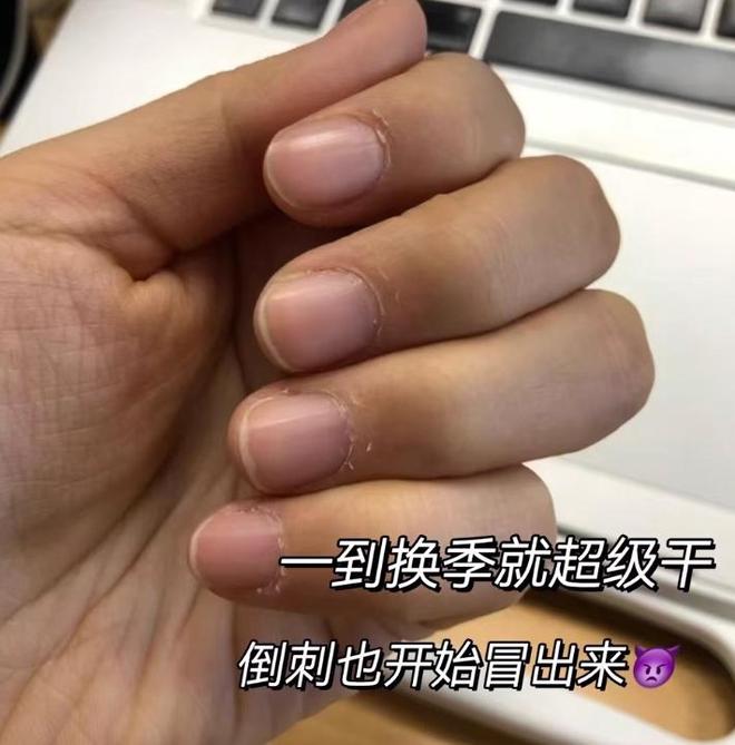 霜哪个牌子的好：护手霜哪个牌子美白保湿好j9九游会(中国)网站2025氨基酸护手(图6)