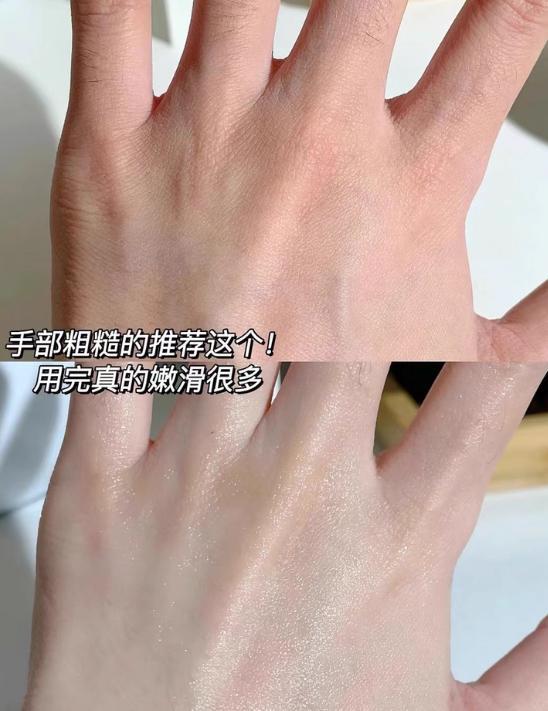 榜：医生建议用的护手霜什么牌子效果好！九